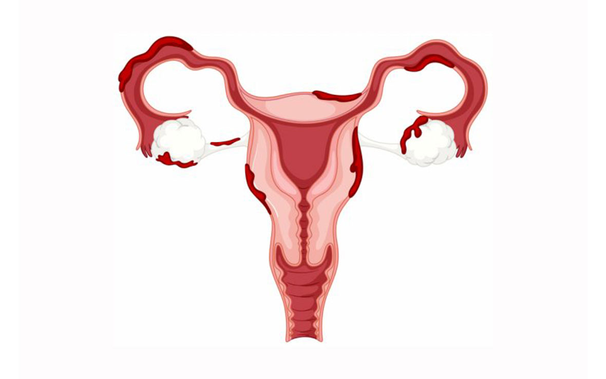 Tamaño endometrio embarazo