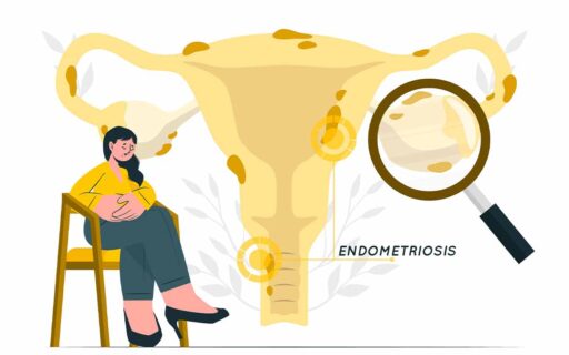 Enometriosi e Dolore Pelvico Cronico