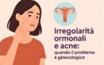 Irregolarità ormonali e acne: quando il problema è ginecologico