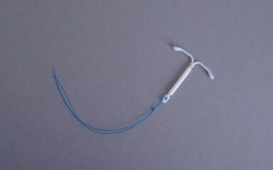 Inserimento della spirale (IUD): come avviene, quando farlo e cosa aspettarsi