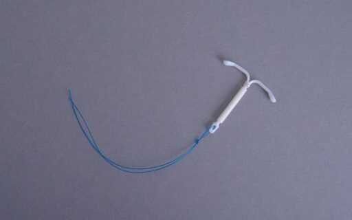 Inserimento della spirale (IUD): come avviene, quando farlo e cosa aspettarsi