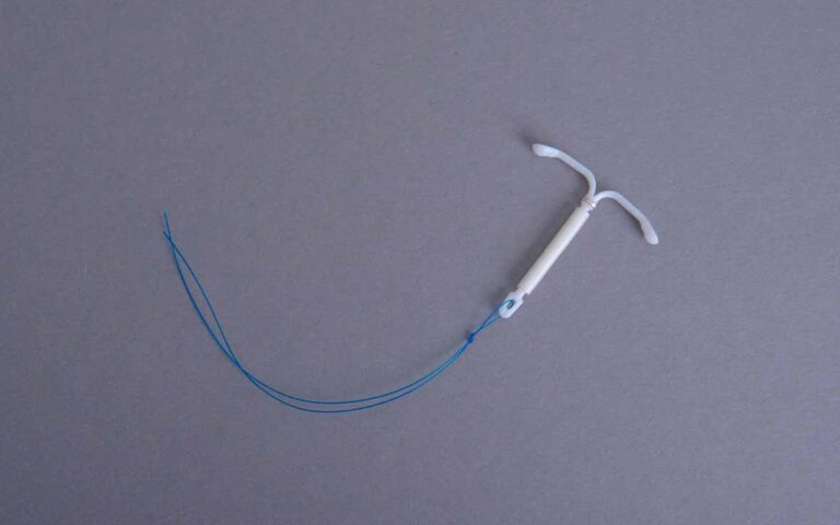 Inserimento della spirale (IUD): come avviene, quando farlo e cosa aspettarsi
