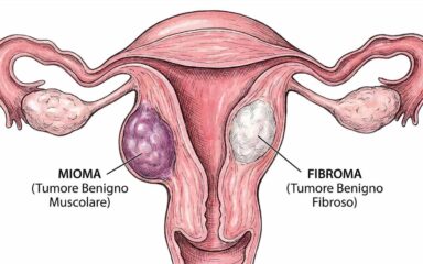Miomi uterini: quando intervenire e quali sono oggi le soluzioni più efficaci